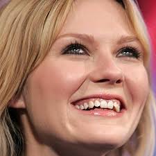 kirsten dunst teeth